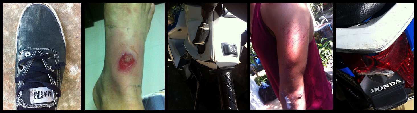 chiang-mai-pai-thailand-bike-motorbike-crash